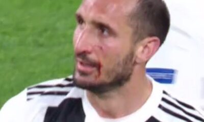 chiellini