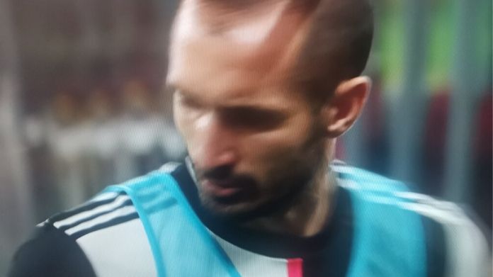 Chiellini 1